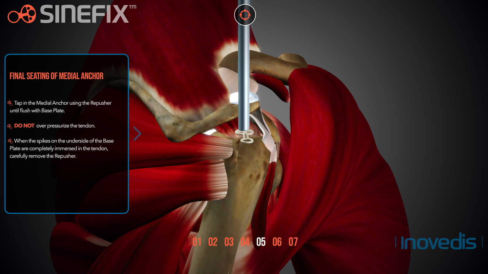 cyberstance.ca/engage3d/sinefix